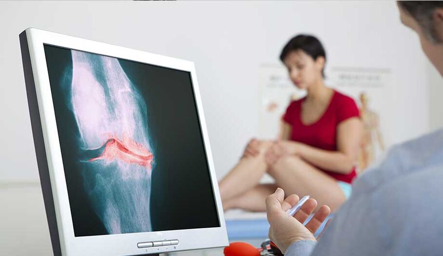 Consultation with a doctor in case of suspected arthritis or osteoarthritis
