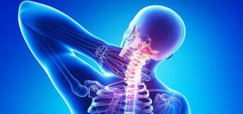 Causes of cervical osteochondosis