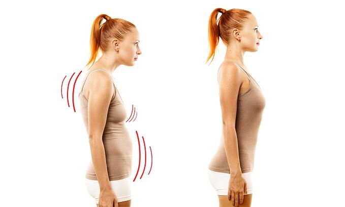 leaning as a cause of the development of lumbar osteochondrosis