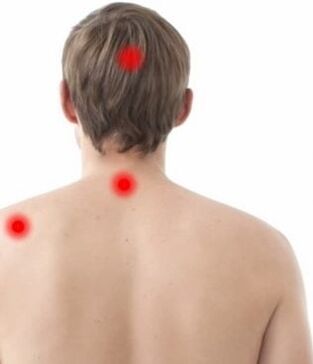 role of pain in cervical osteochondrosis
