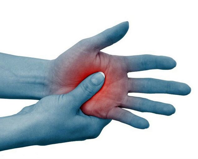 Severe pain in the finger joints, decreasing with exercise, is a typical sign of rheumatoid arthritis.